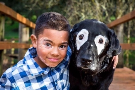 ბავშვს, რომელსაც  კანის ქრონიკული დაავადება აქვს, დეპრესიის დაძლევაში ძაღლი დაეხმარა